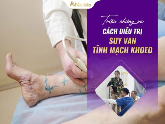 suy van tĩnh mạch khoeo