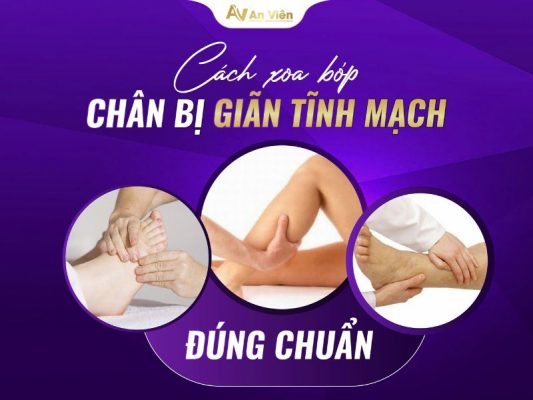 cách xoa bóp chân bị giãn tĩnh mạch