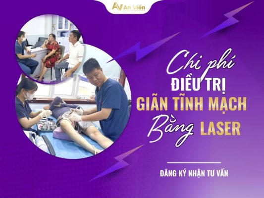 chi phí điều trị giãn tĩnh mạch bằng laser
