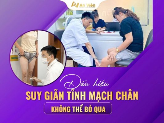 dấu hiệu suy giãn tĩnh mạch chân