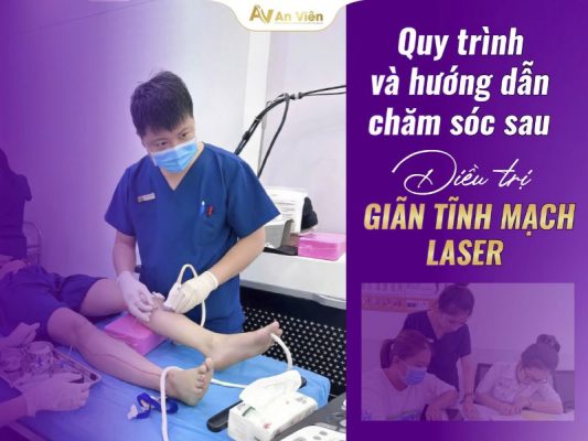 đốt laser giãn tĩnh mạch chân
