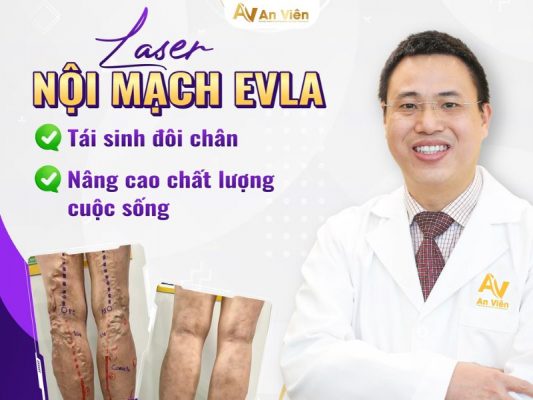 đốt laser suy tĩnh mạch chân