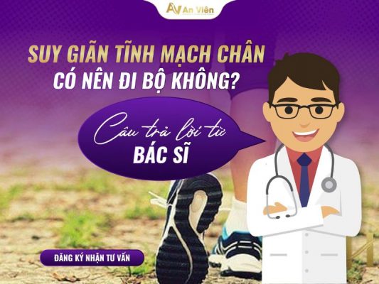 giãn tĩnh mạch có nên đi bộ không