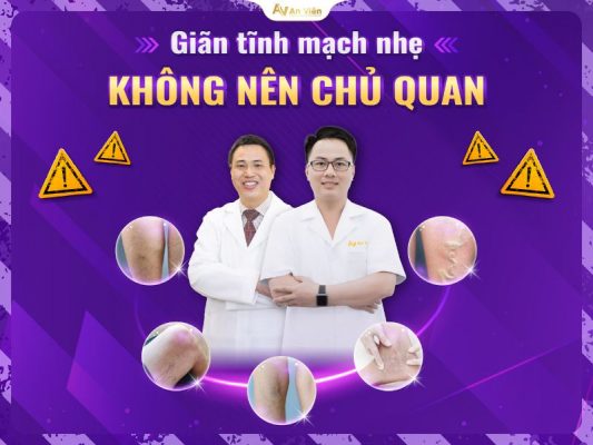 giãn tĩnh mạch nhẹ