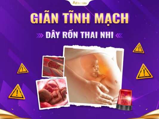 giãn tĩnh mạch rốn thai nhi