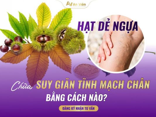 hạt dẻ ngựa suy giãn tĩnh mạch