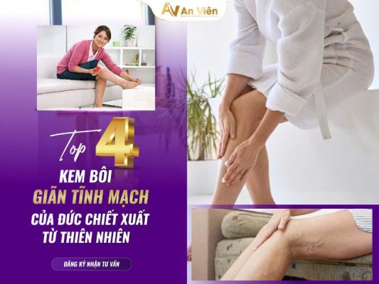 kem bôi giãn tĩnh mạch của đức