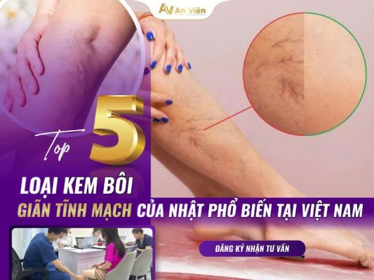 kem bôi giãn tĩnh mạch của Nhật