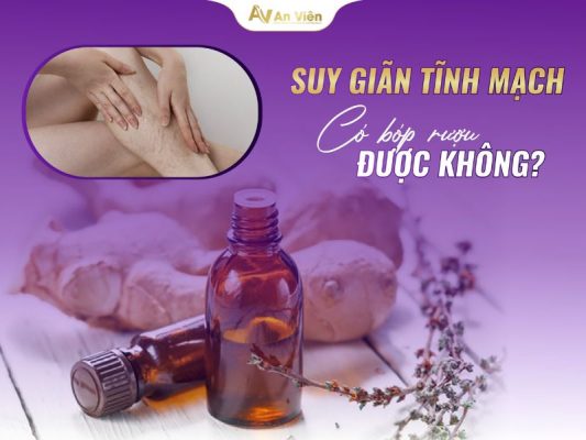 suy giãn tĩnh mạch có bóp rượu được không