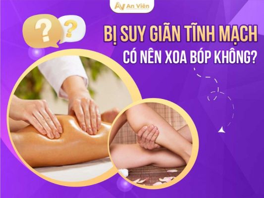 suy giãn tĩnh mạch có nên xoa bóp không