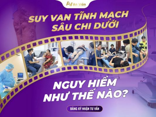 suy tĩnh mạch sâu hai chi dưới