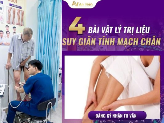 vật lý trị liệu suy giãn tĩnh mạch chân
