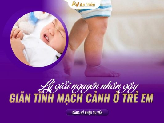 giãn tĩnh mạch cảnh ở trẻ em