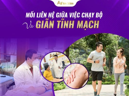 giãn tĩnh mạch có chạy bộ được không