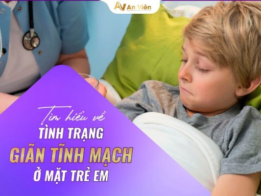 giãn tĩnh mạch ở mặt trẻ em