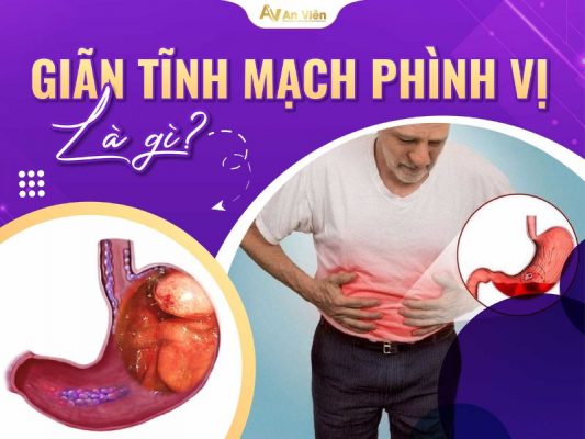 giãn tĩnh mạch phình vị