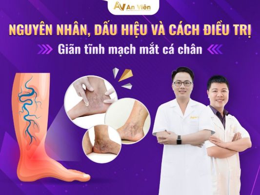 giãn tĩnh mạch mắt cá chân