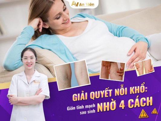 giãn tĩnh mạch sau sinh